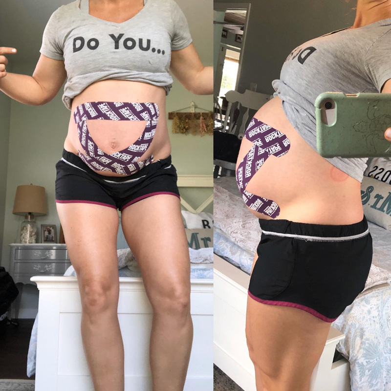 Prenatal - Stuart and Port St Lucie Chiropractor